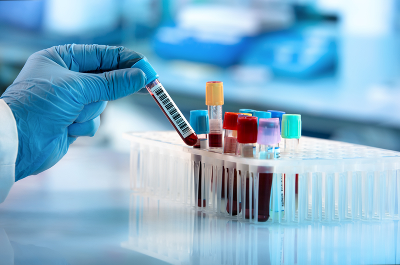 blood type, labs tests