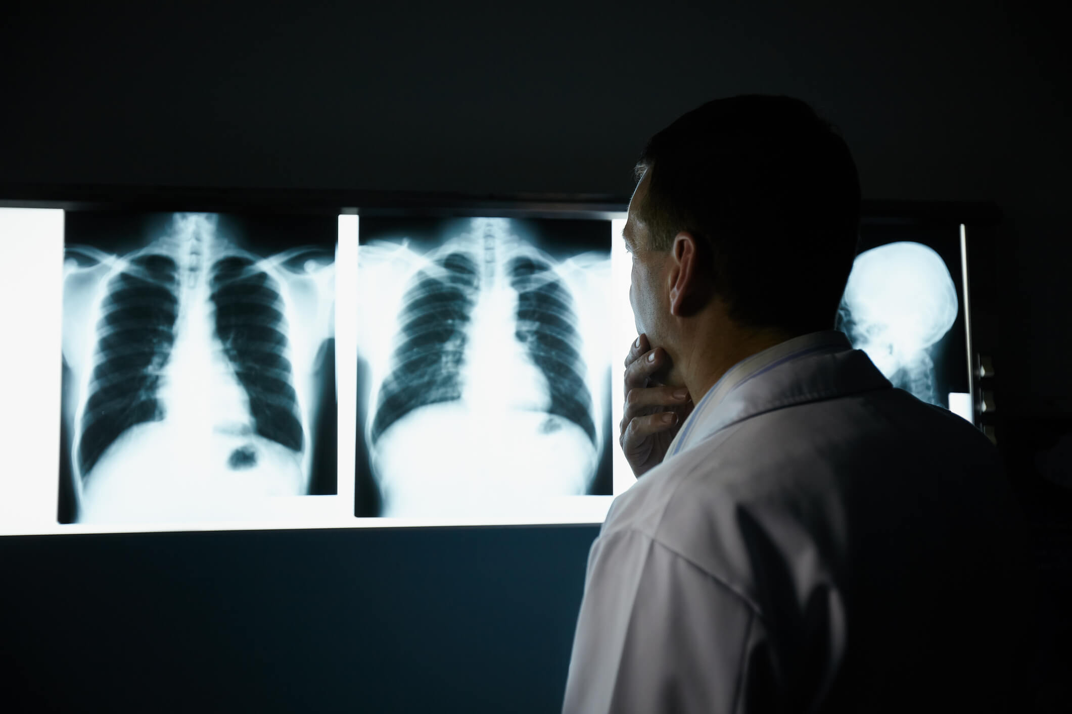 Doctor in hospital during examination of x-rays. Male doctor at work in public medical clinic and examining x-ray plates of bones, skull and lungs