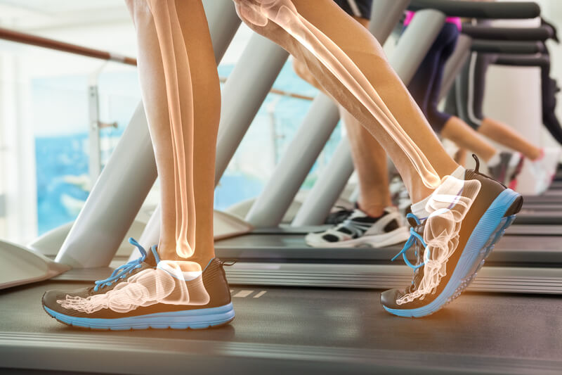 bone health over 50