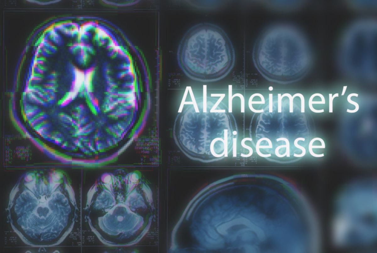 Alzheimer’s & Brain Awareness Month