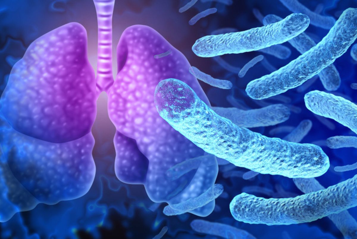 Legionnaires Disease and Legionella pneumophila bacteria outbreak and respiratory illness as a serious form of pneumonia as a pathology microbiology and Epidemiology symbol for antibiotic treatment with infected lungs
